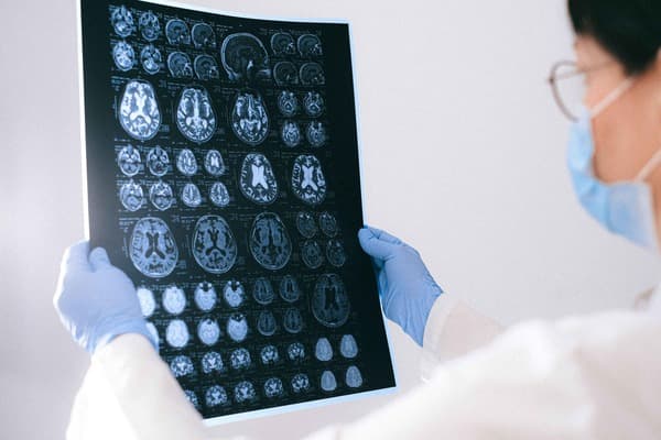 Researching tinnitus mechanisms